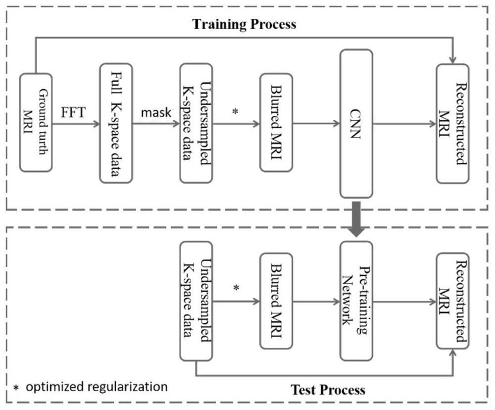 Optimized regularization and CNN-based undersampled magnetic resonance image high-performance reconstruction method