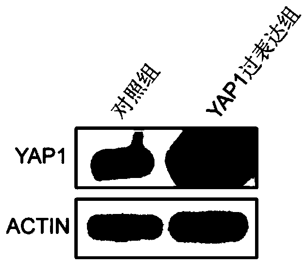 YAP1 gene modified mesenchymal stem cells and preparation method thereof