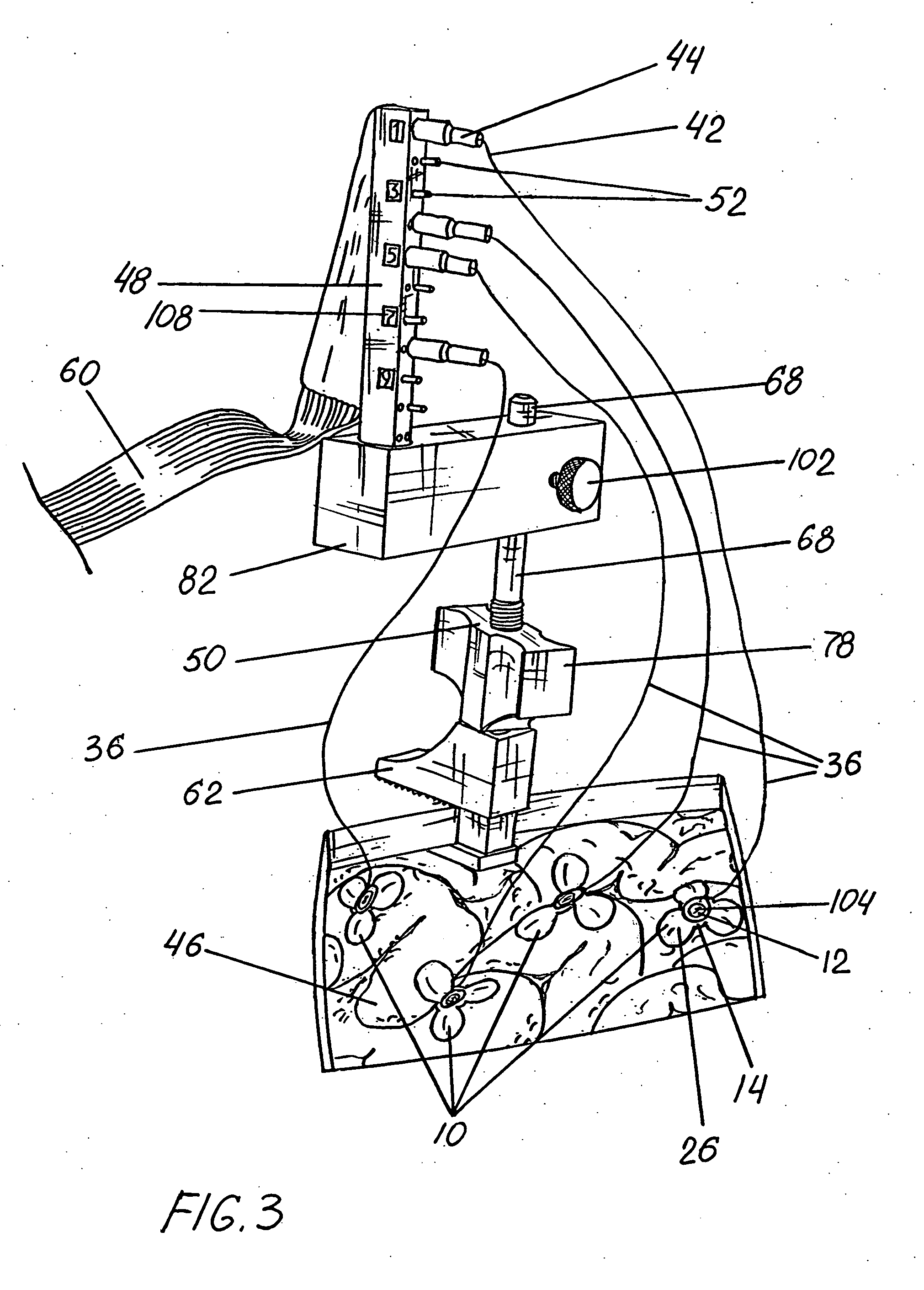 Cortical sensing device with pads