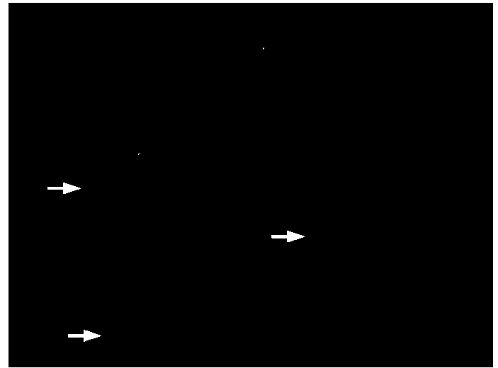 Detection kit and detection method of phosphorylation of sperm tyrosine