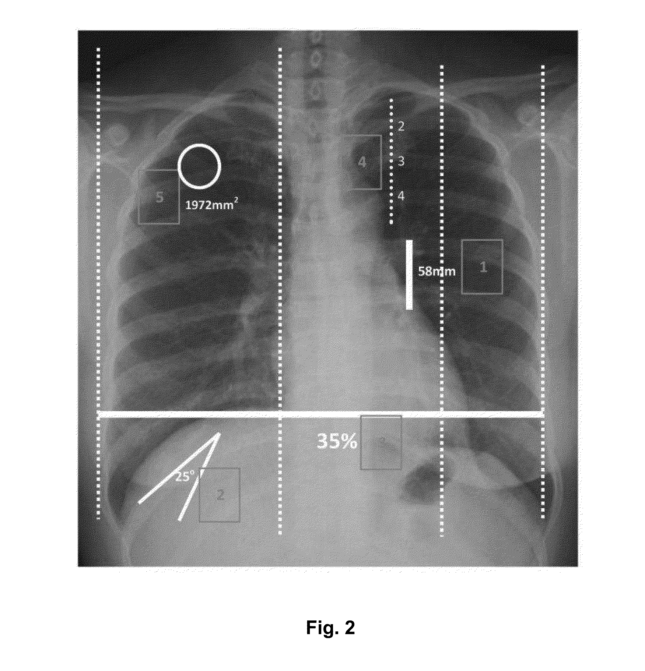 Apparatus and method for generating inspection report(s)