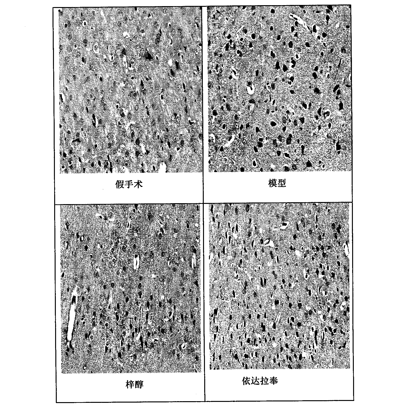 Application of catalpol in preparation of medicine for treating ischemic cerebral apoplexy sequelae