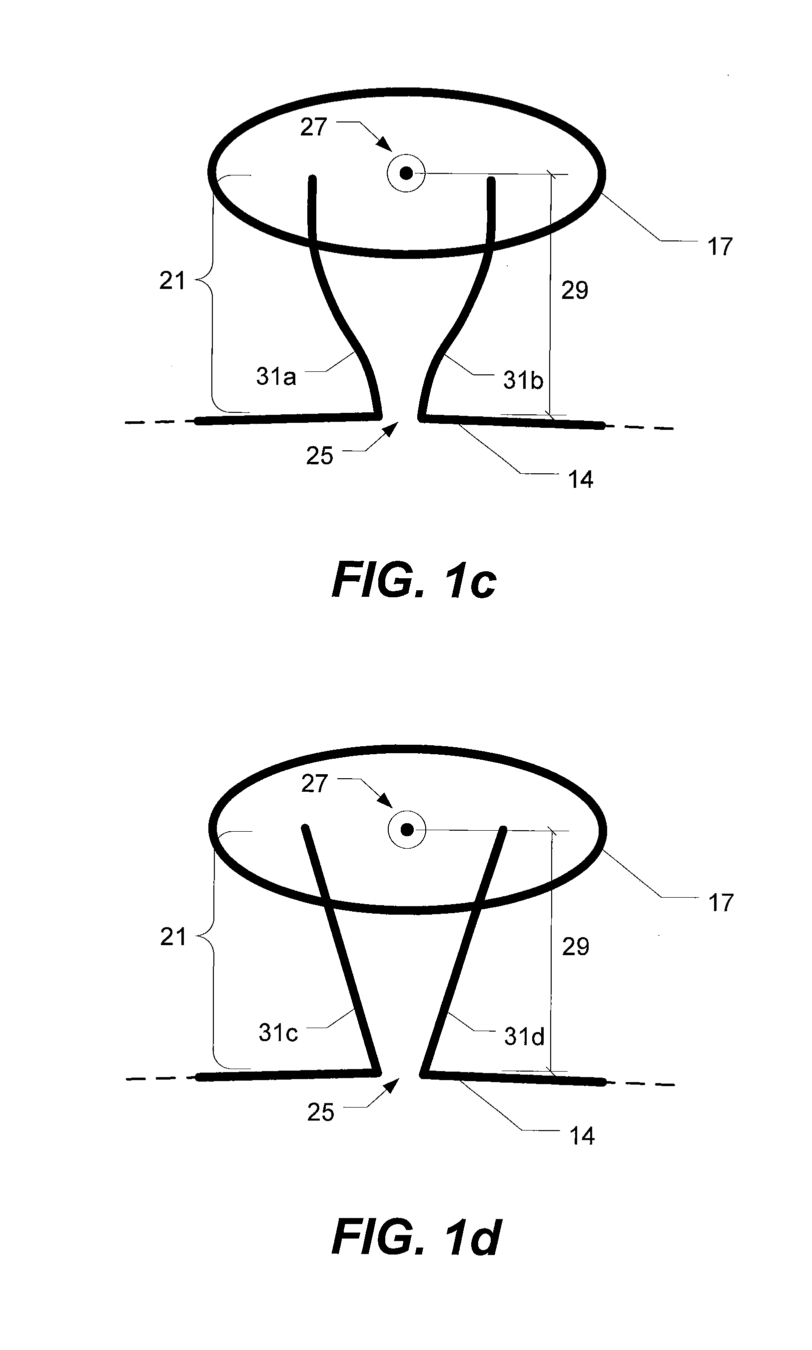 Capsulotomy repair device and method for capsulotomy repair