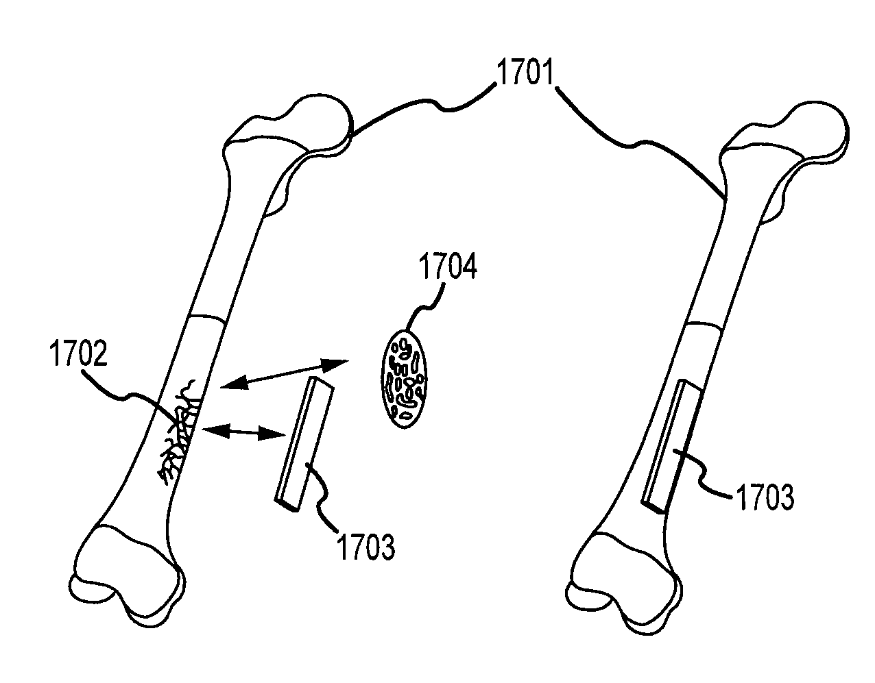 Chemical Mechanical Vapor Deposition Device for Production of Bone Substitute Material