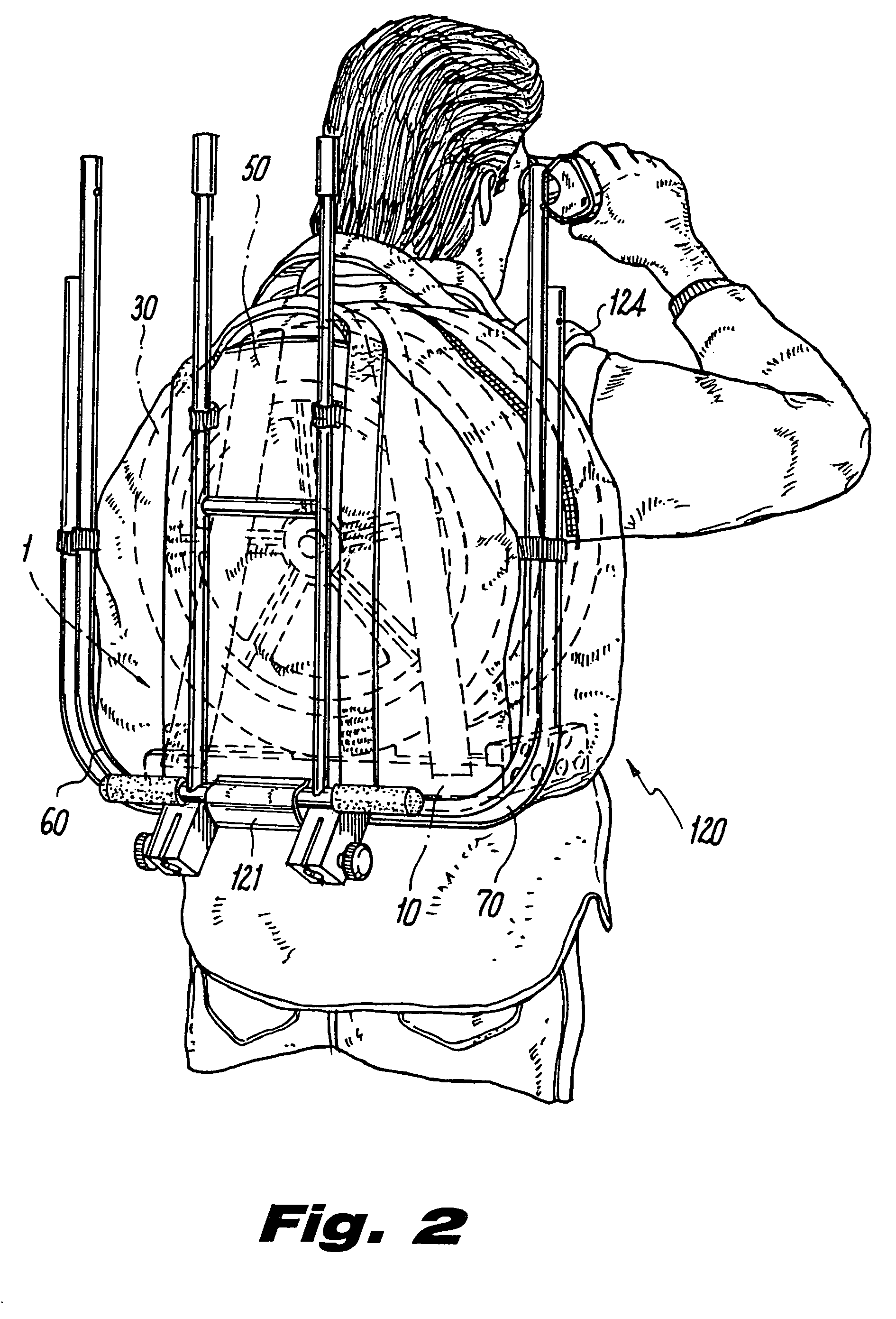 Wholly portable, modular, expandable, medical critical care field installation system