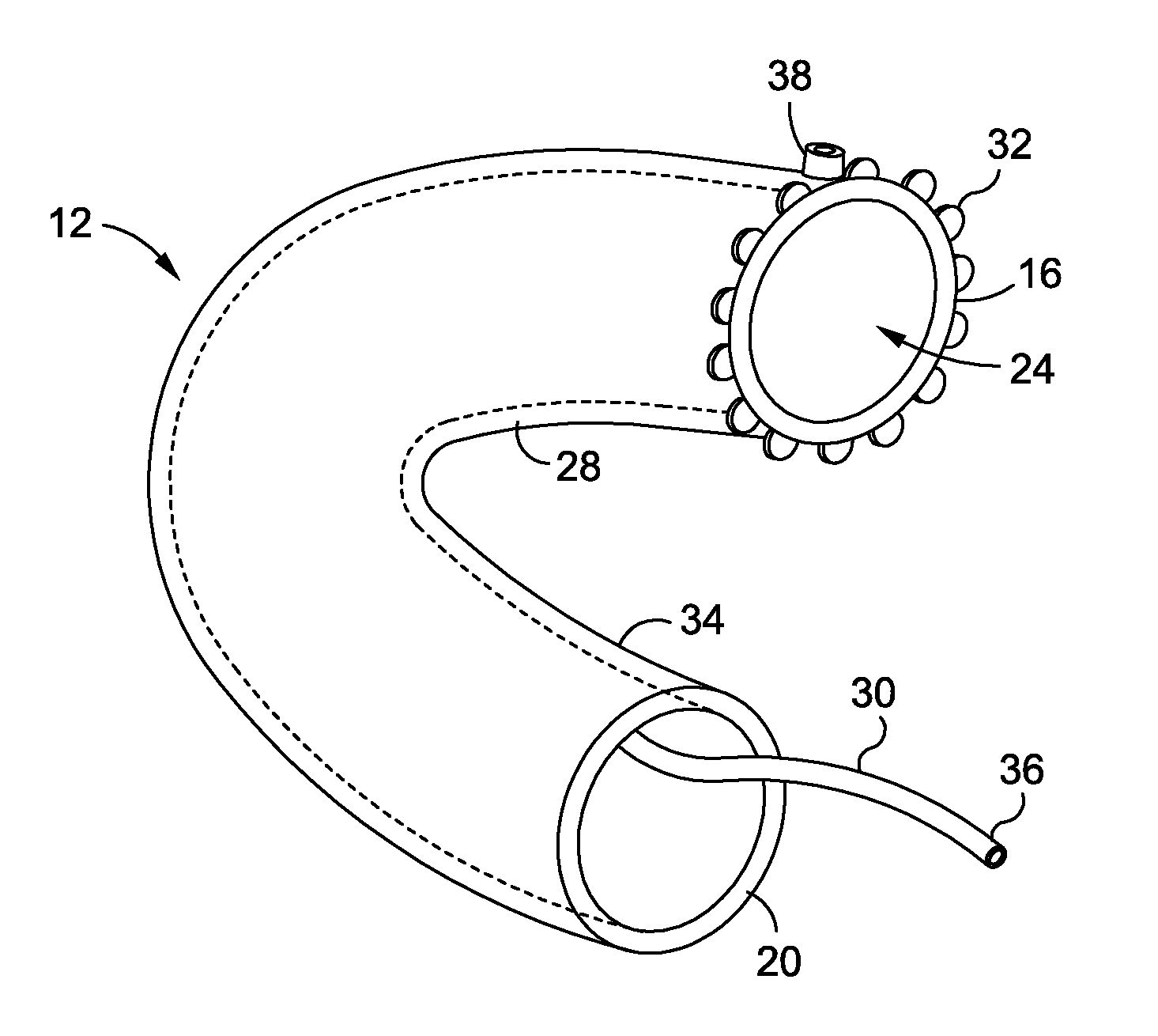 Intraluminal sleeve with active agents