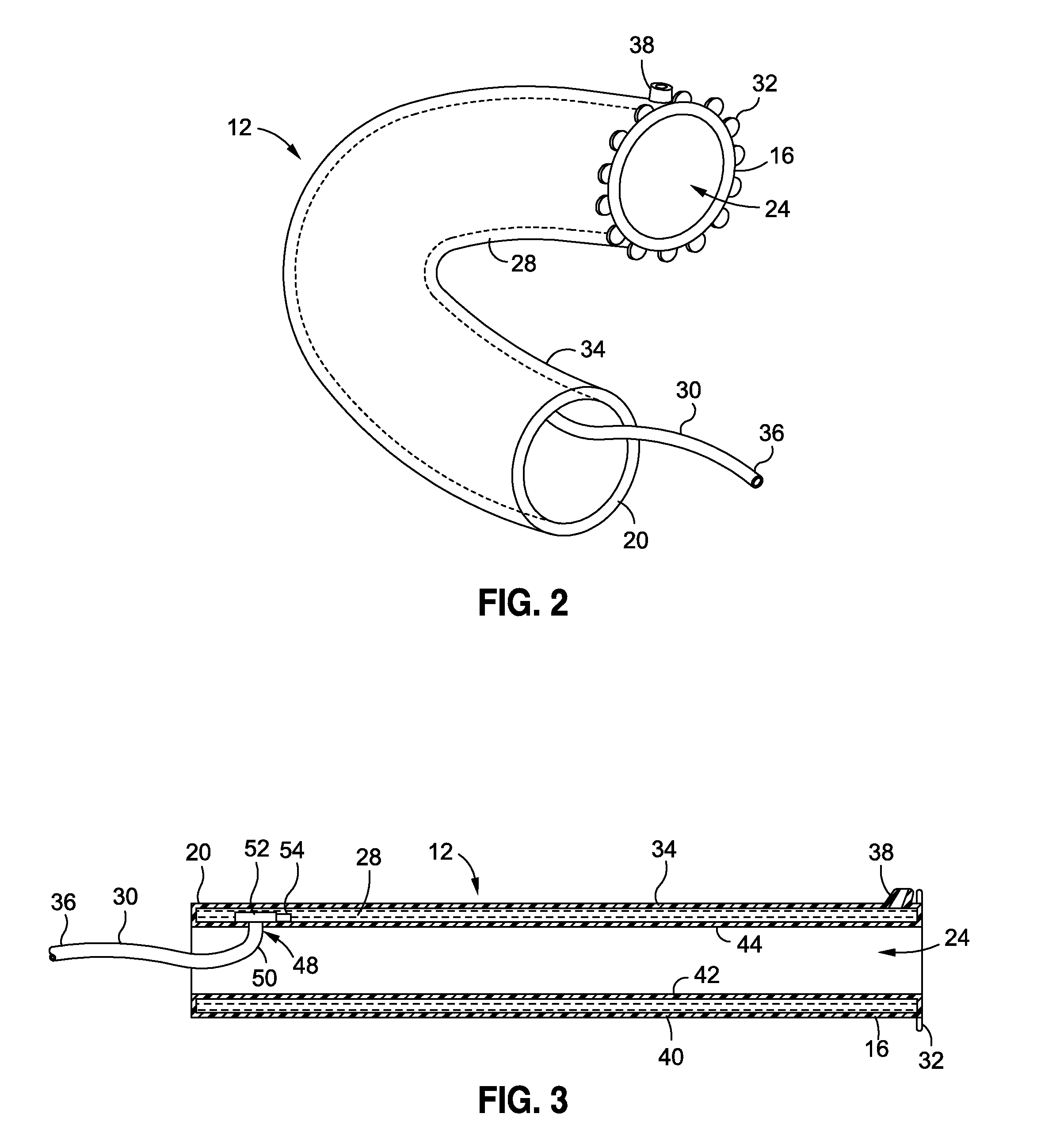 Intraluminal sleeve with active agents