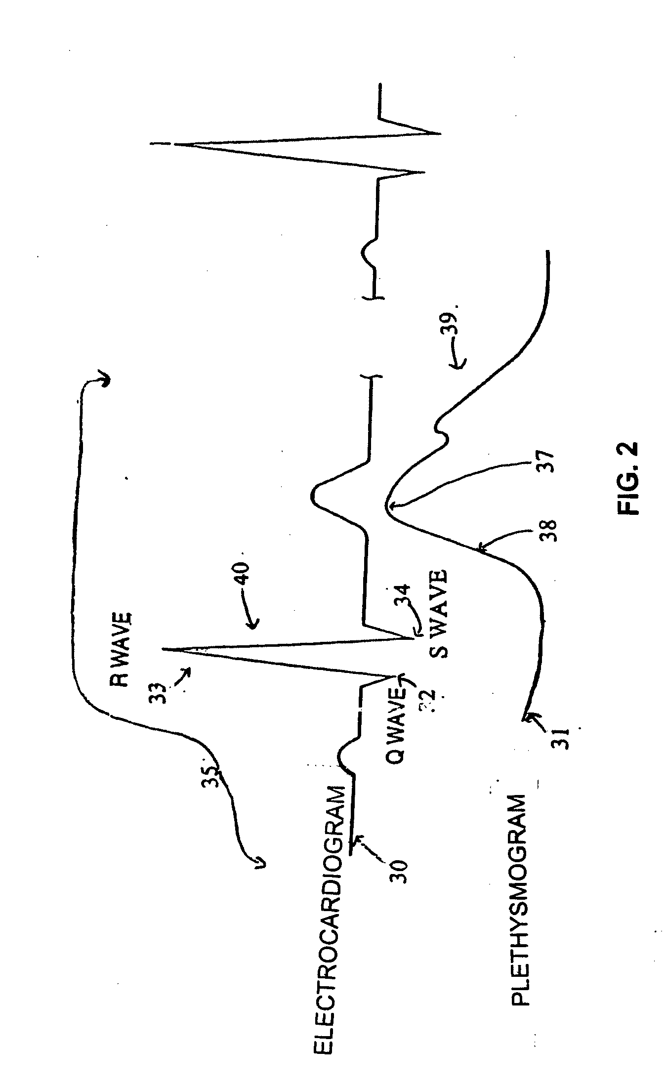 Systems and methods for providing sensor fusion