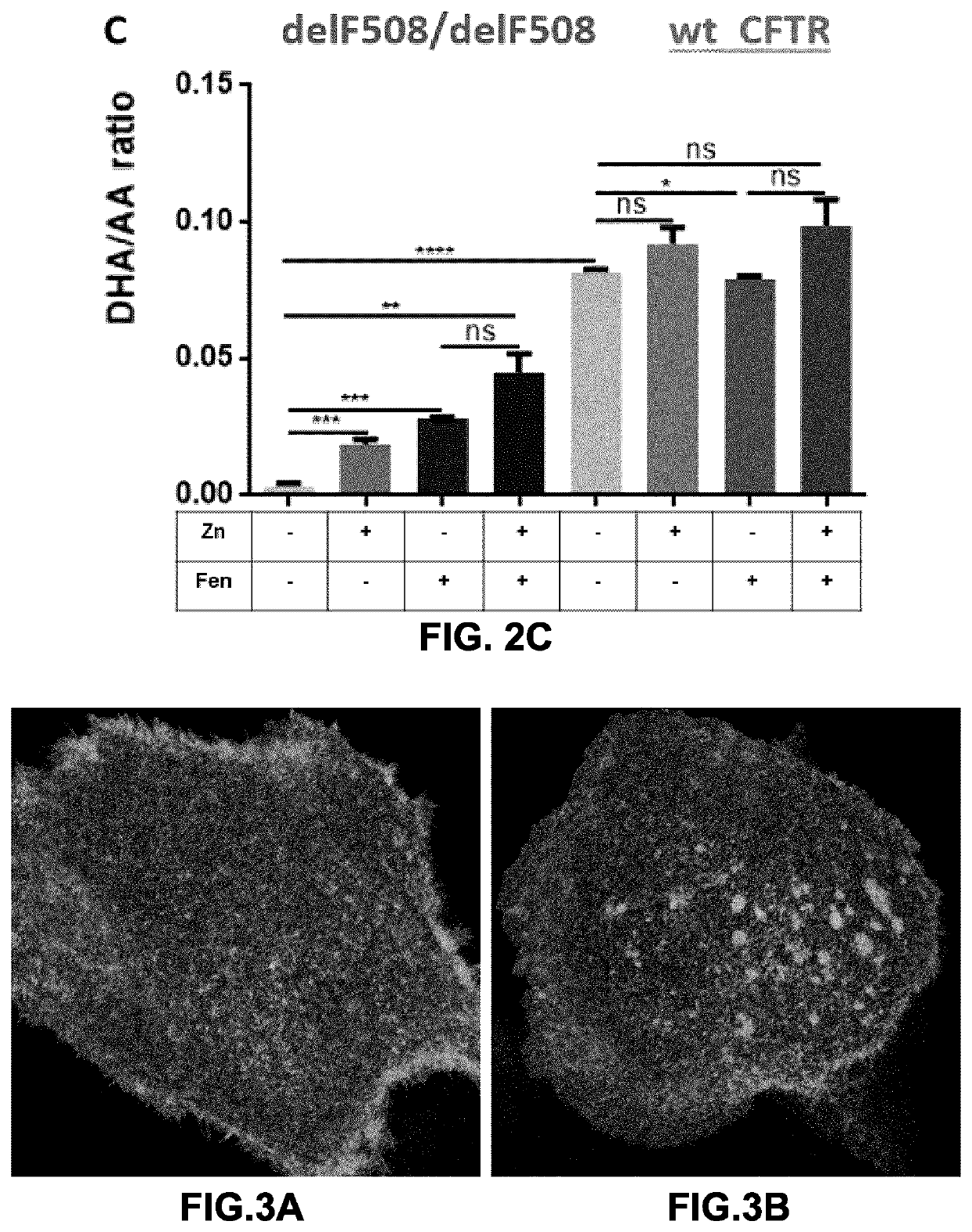 Compositions and methods for enhancing ion transporter activity and uses thereof