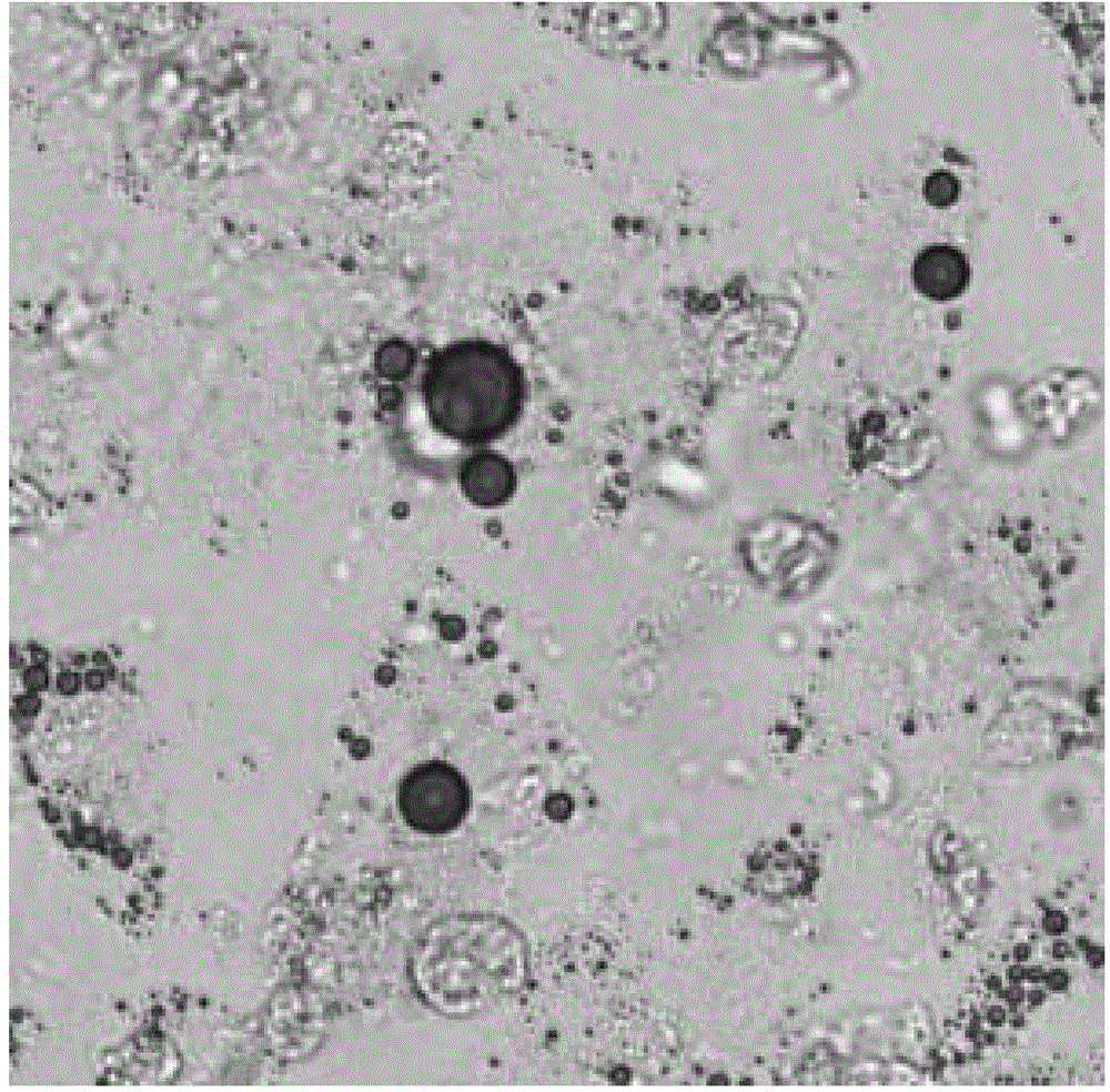 Composition of human adipose derived mesenchymal progenitor cells and adipose derived stromal vascular fraction for treating hepatitis B