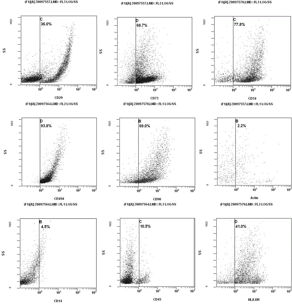 Composition of human adipose derived mesenchymal progenitor cells and adipose derived stromal vascular fraction for treating hepatitis B