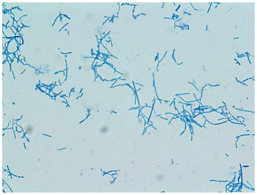 A kind of Lactobacillus helveticus bacterial strain and application thereof