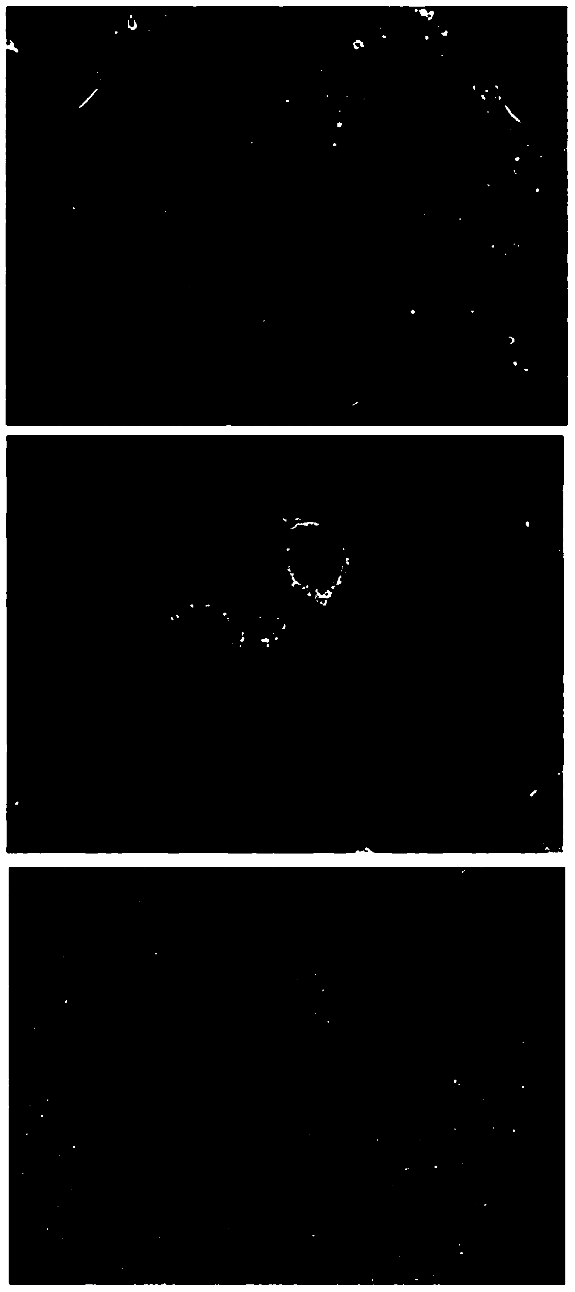 Method for inducing human embryonic stem cells to differentiate into retinal pigment epithelial cells in vitro