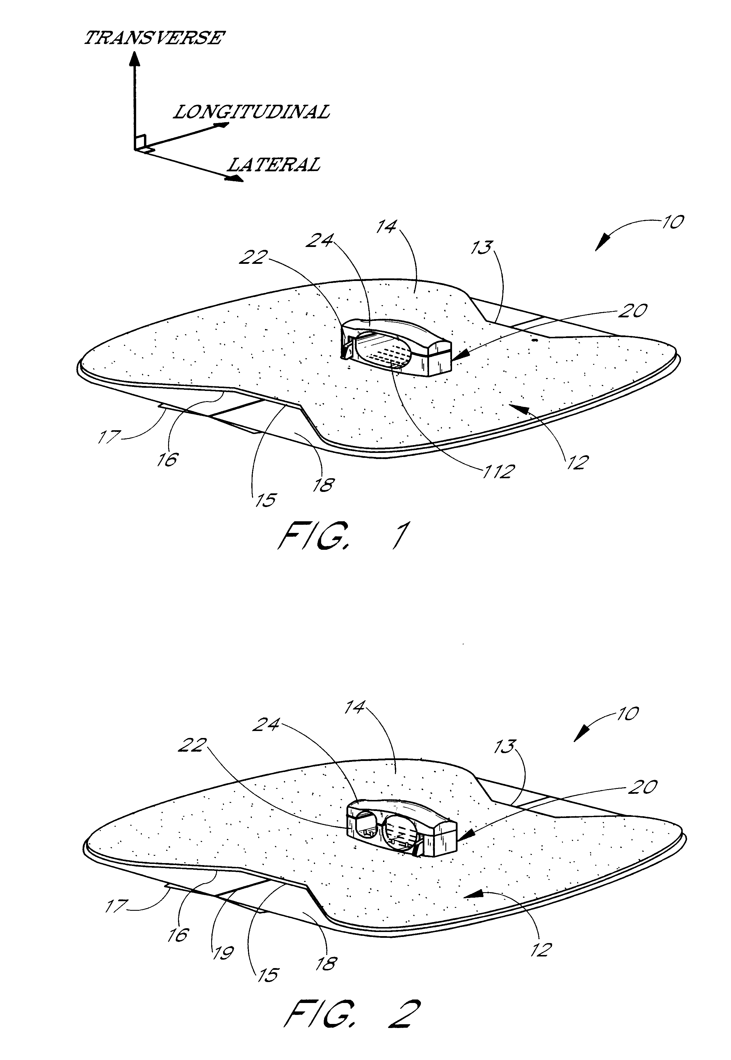 Anchoring system for a medical article