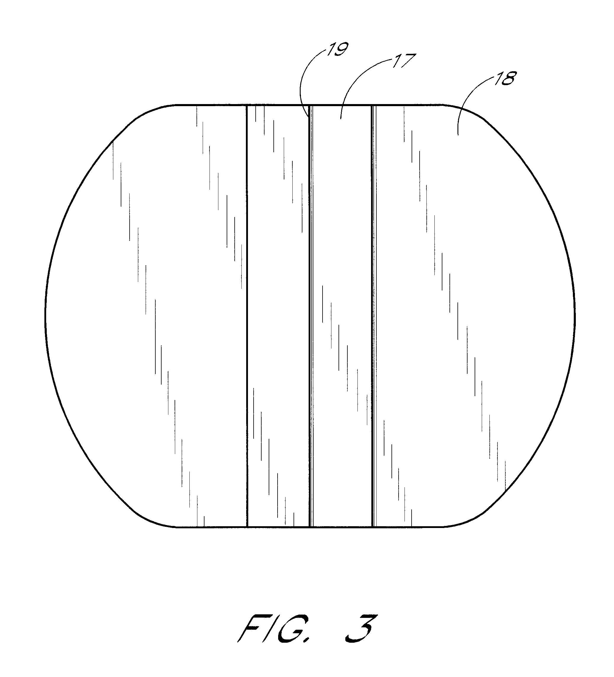 Anchoring system for a medical article