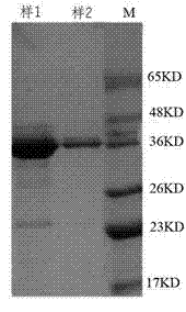 Mouse anti-human neutrophil gelatinase-associated lipocalin (NGAL) monoclonal antibodies and hybridoma cell strains and application thereof