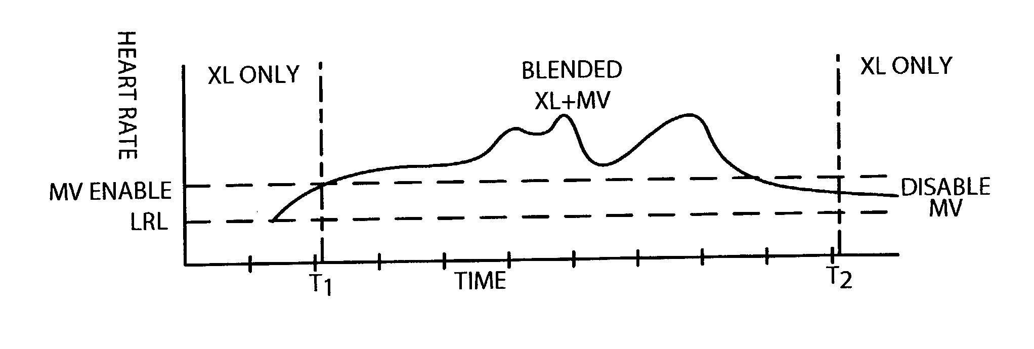 Method of operating implantable medical devices to prolong battery life