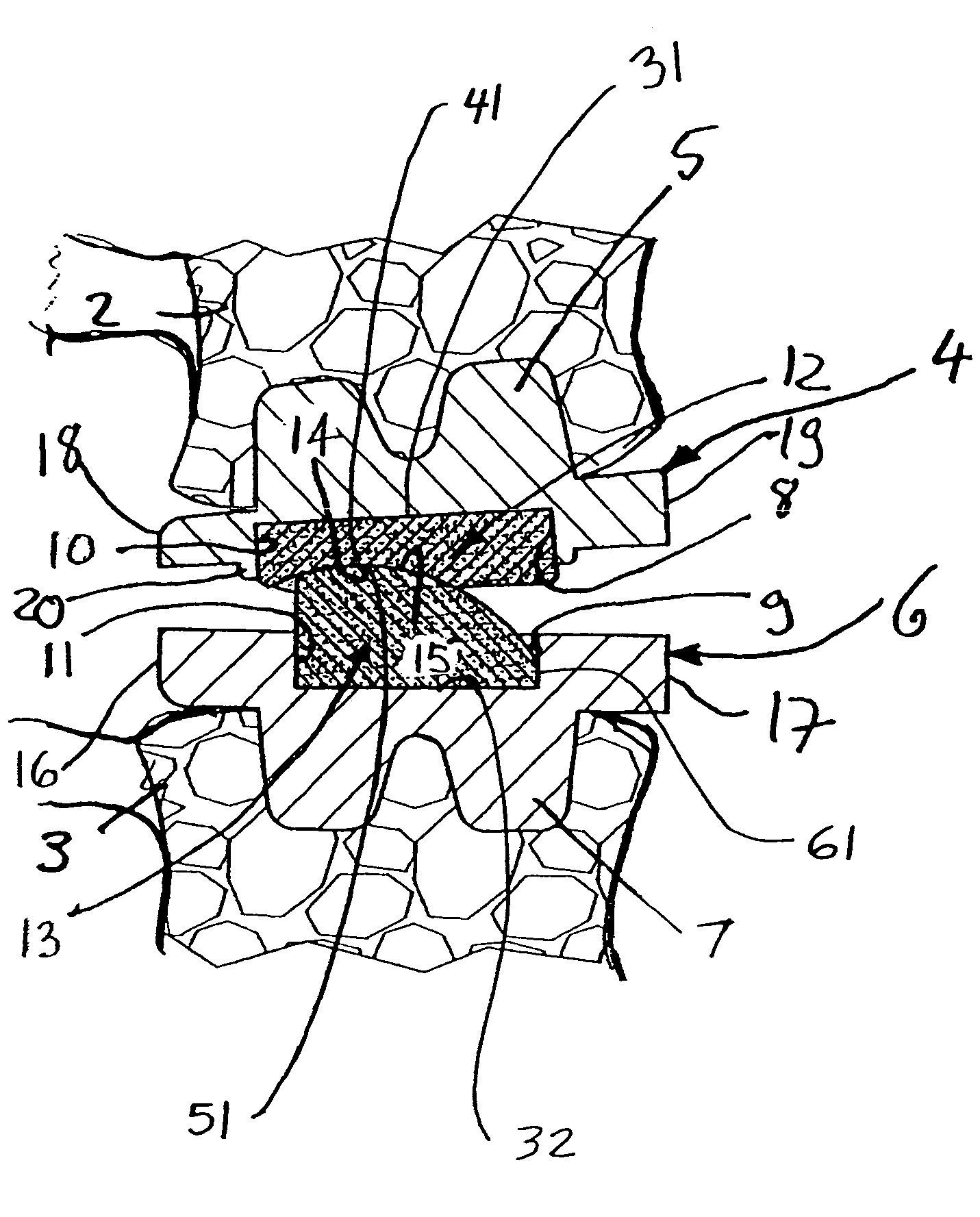 Intervertebral implant