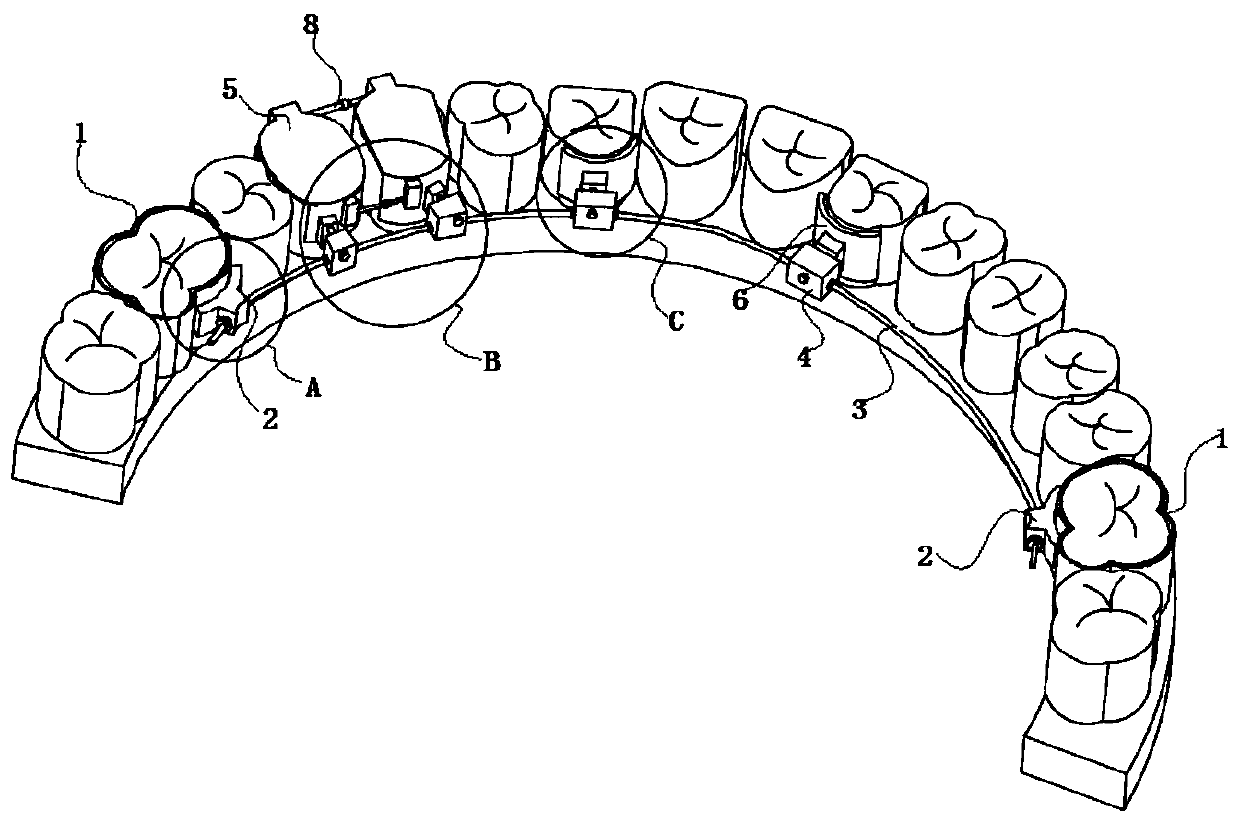 Orthodontics device