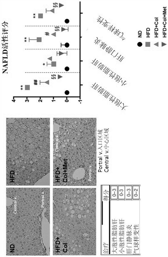 Colchicine combination formulation for treating liver diseases or enhancing curative effect