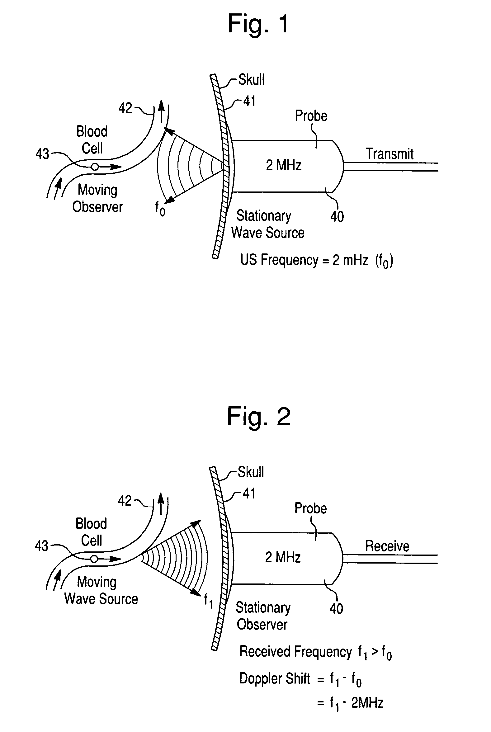 Systems and methods for using dynamic vascular assessment to distinguish among vascular states and for investigating intracranial pressure