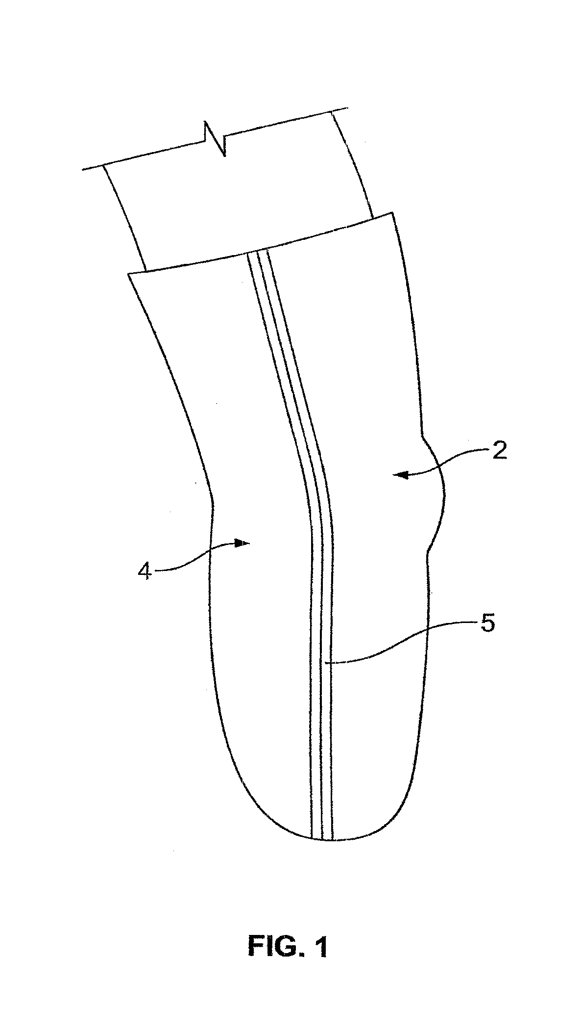 Prosthetic Locking Liner With Improved Knee Flexion