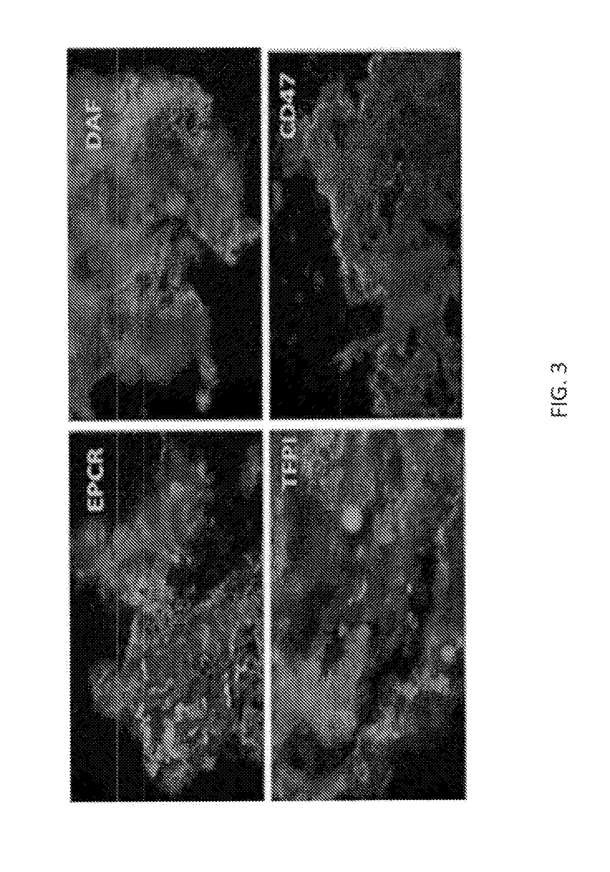 Multi-Transgenic Pig for Xenotransplantation