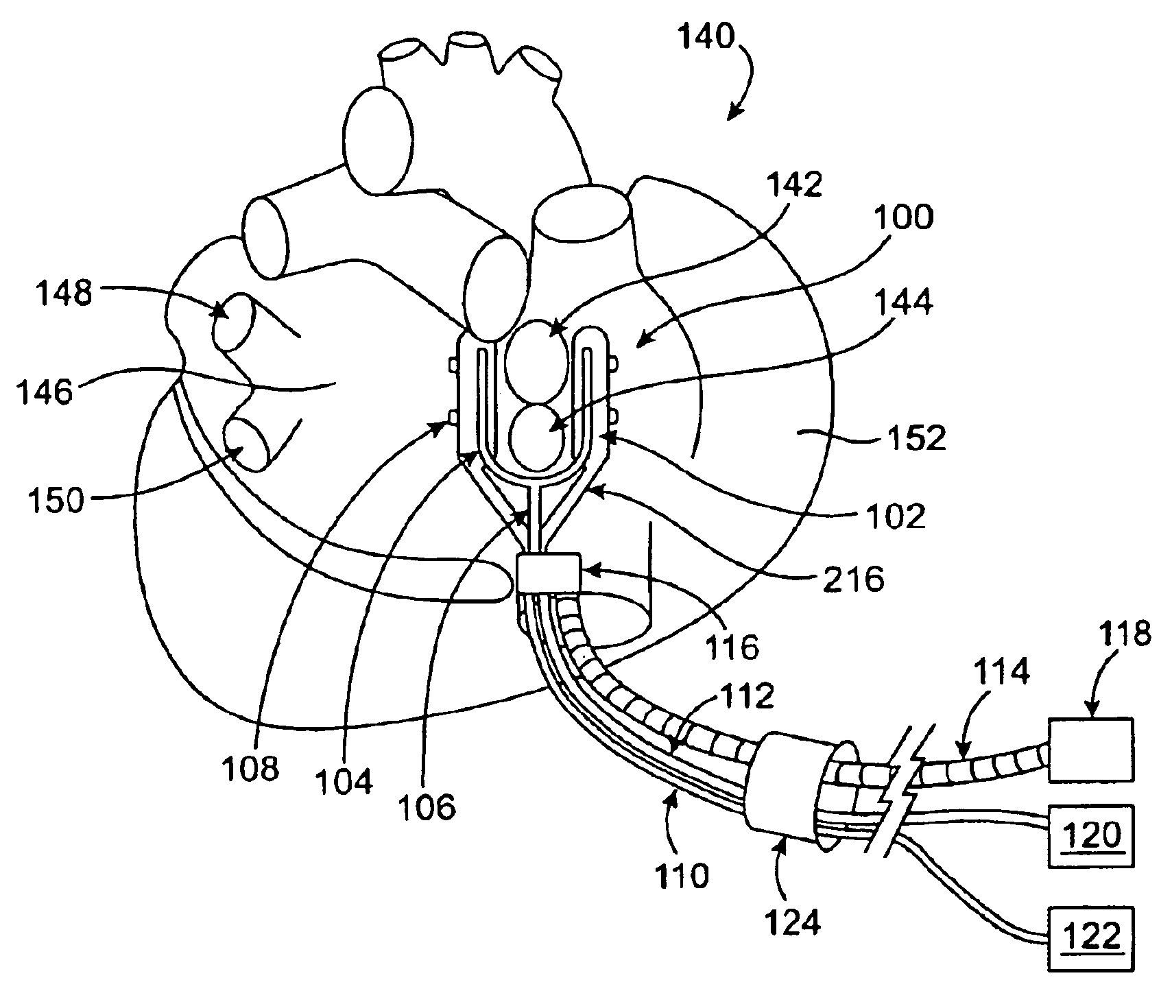 Conduction block verification probe and method of use