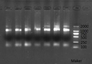 A kind of recombinant Periplaneta americana thymosin protein pathy1 and its expression method