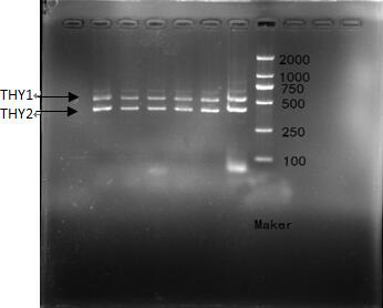 A kind of recombinant Periplaneta americana thymosin protein pathy1 and its expression method