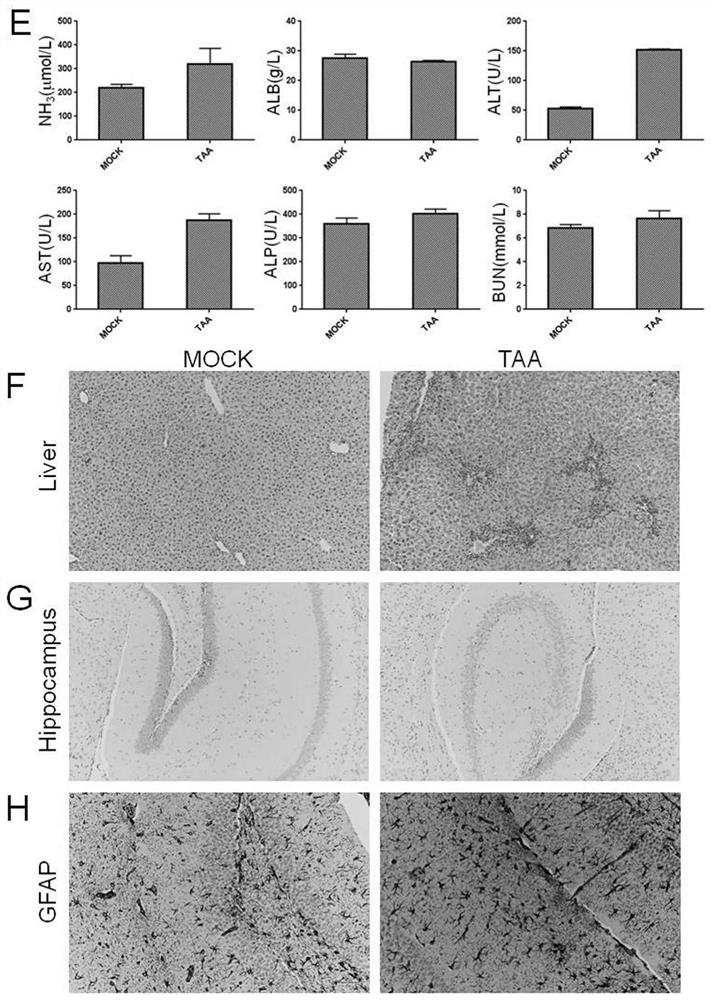 Application of fxr agonists in the treatment of hepatic encephalopathy