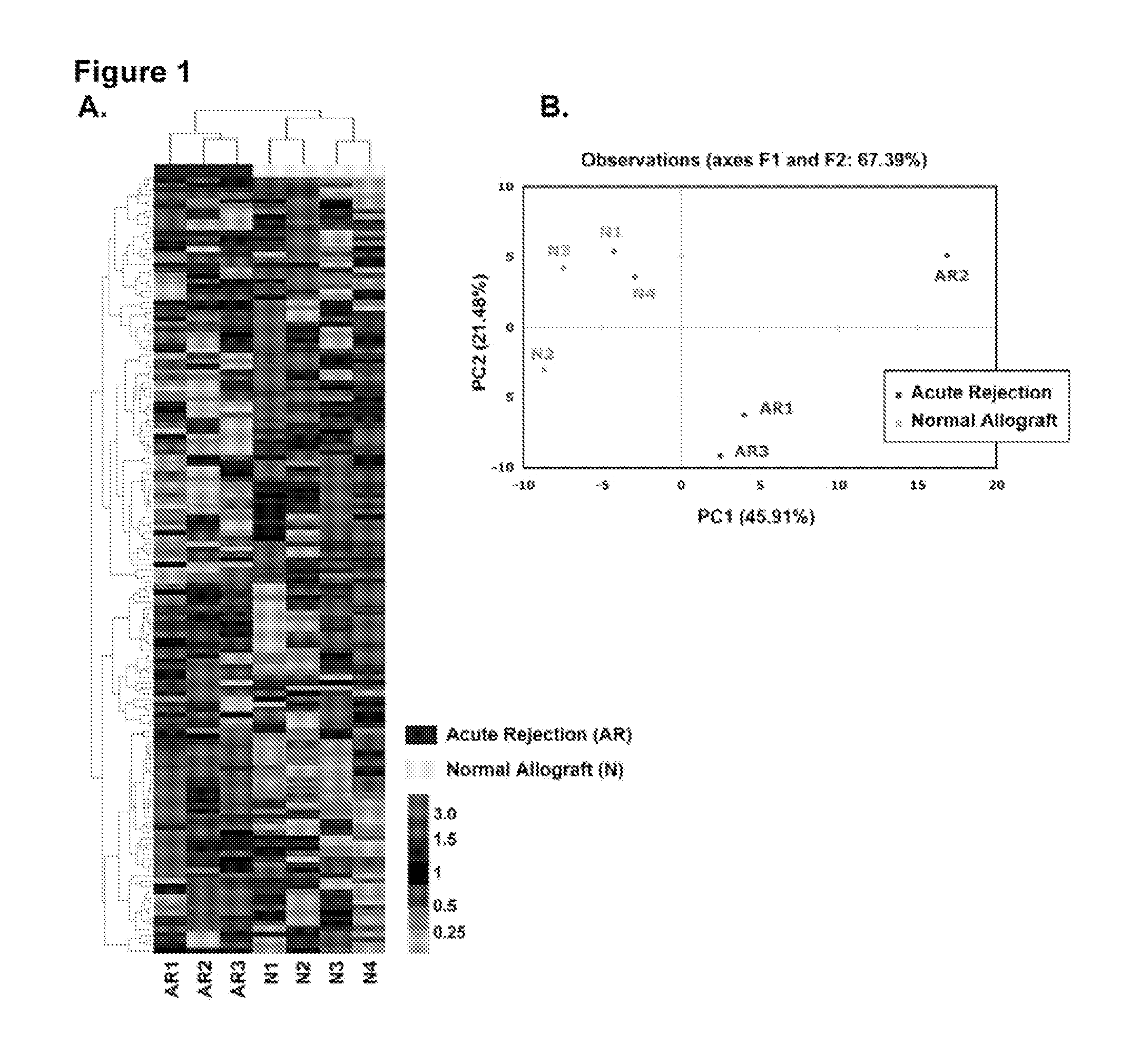 Method to assess human allograft status from microrna expression levels