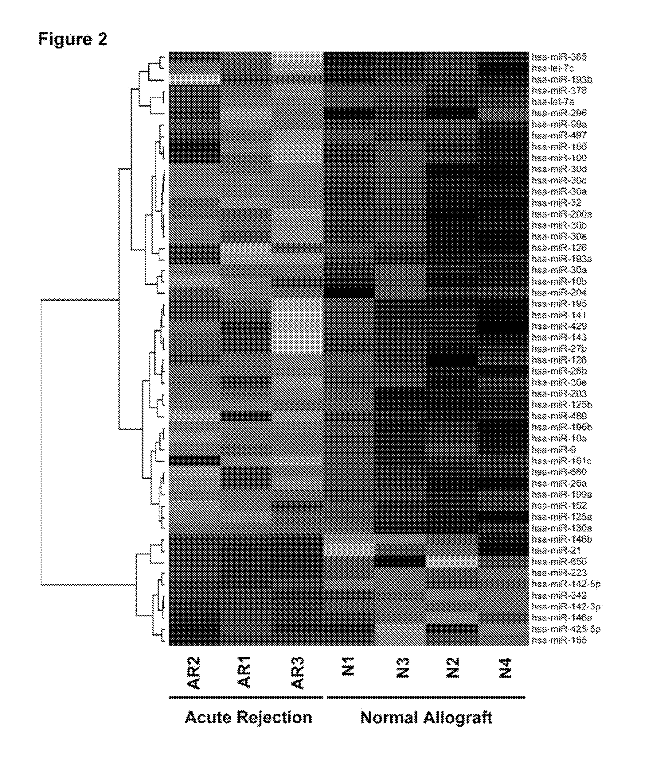 Method to assess human allograft status from microrna expression levels