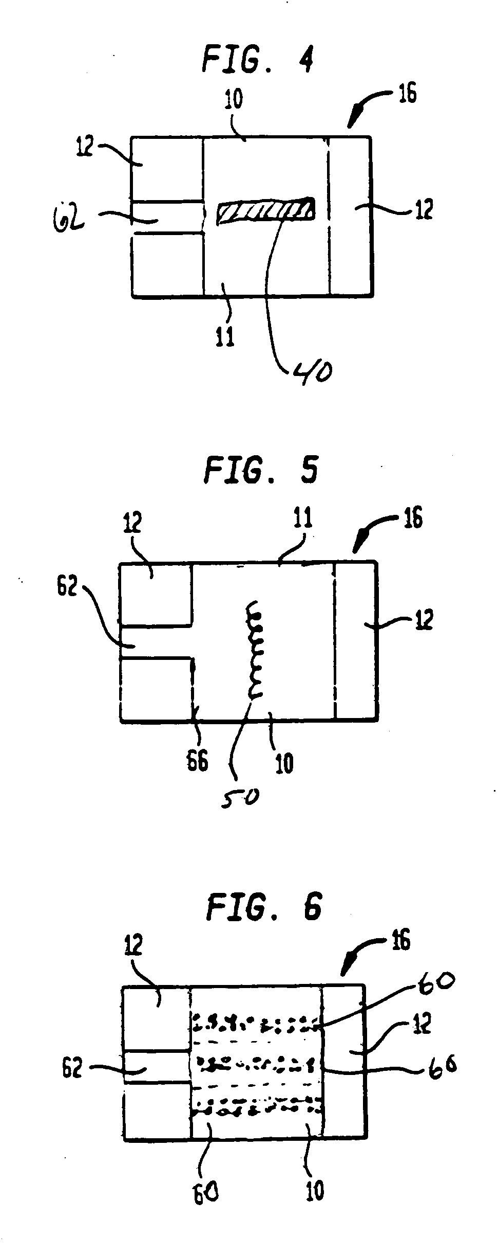 Radiovisible hydrogel intervertebral disc nucleus