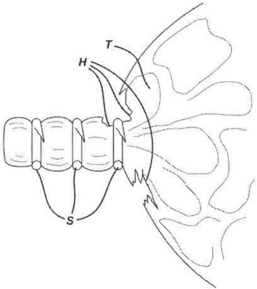 Methods and devices for reinforcing a staple line