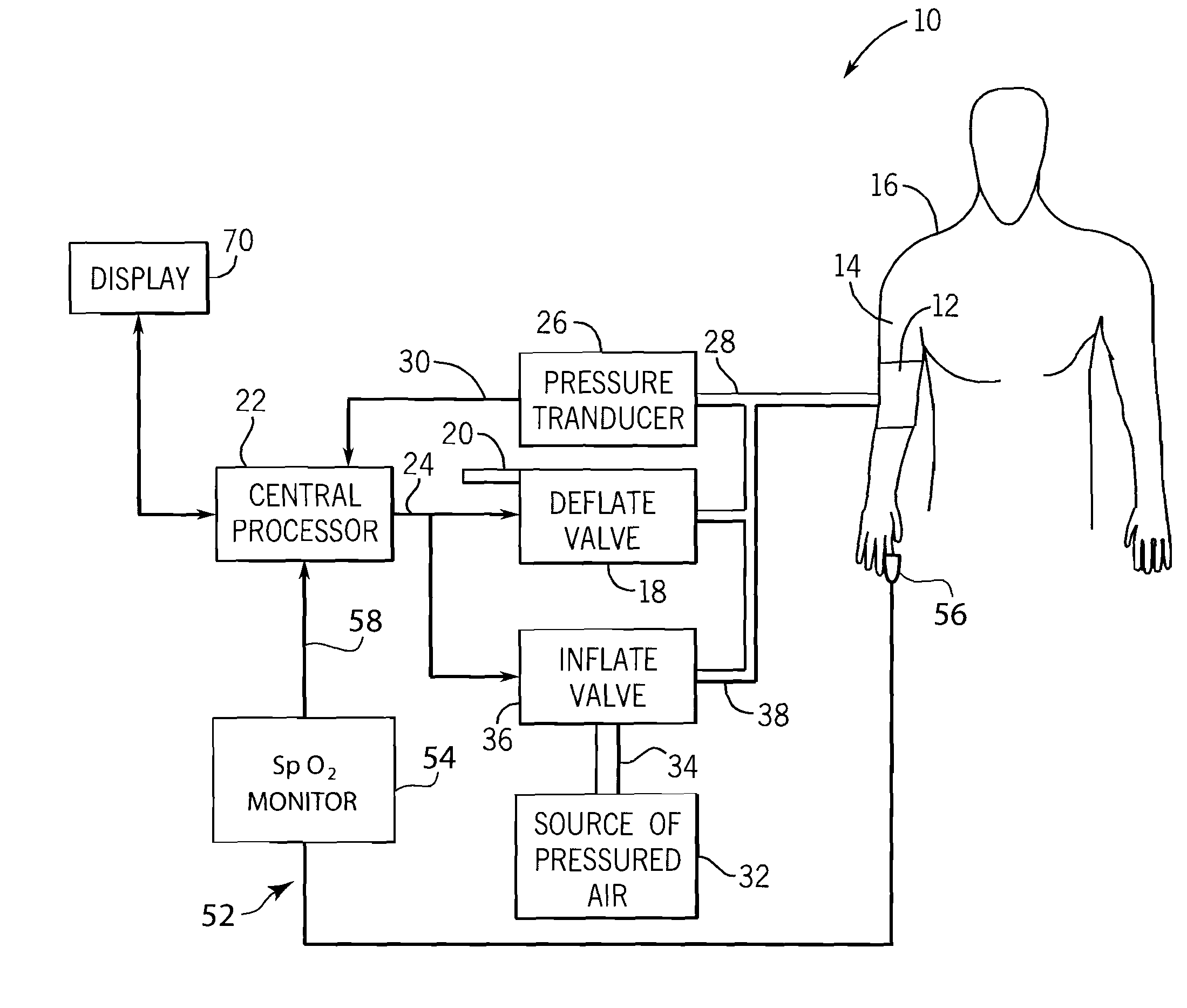 Method and system of determining nibp target inflation pressure using an sp02 plethysmograph signal