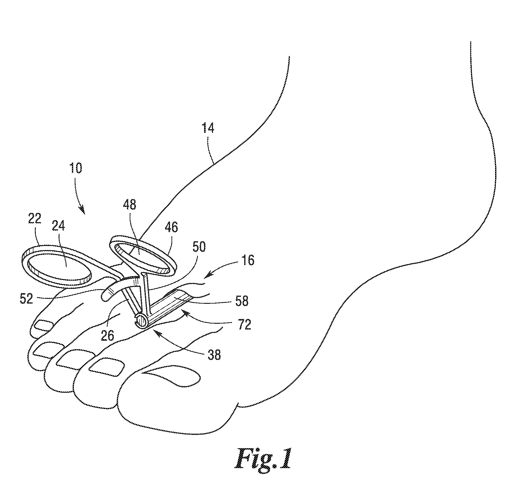 Co-axial actuated scissors