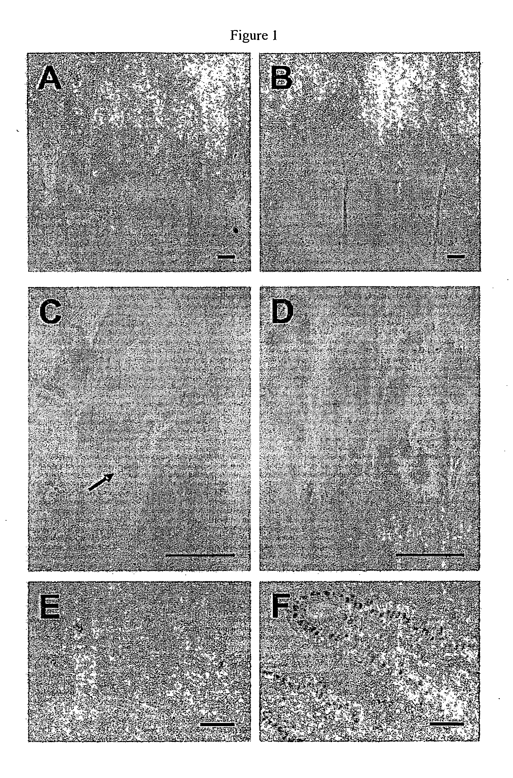 Methods of screening for cell proliferation or neoplastic disorders