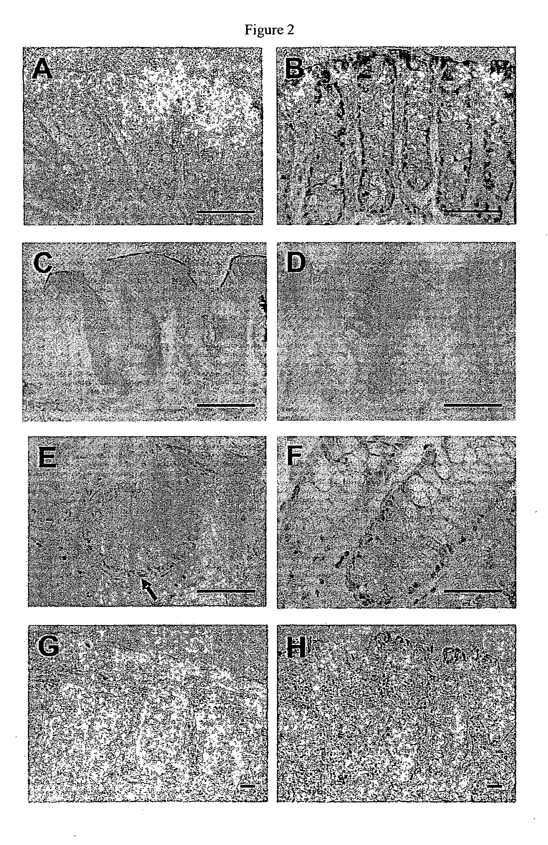 Methods of screening for cell proliferation or neoplastic disorders