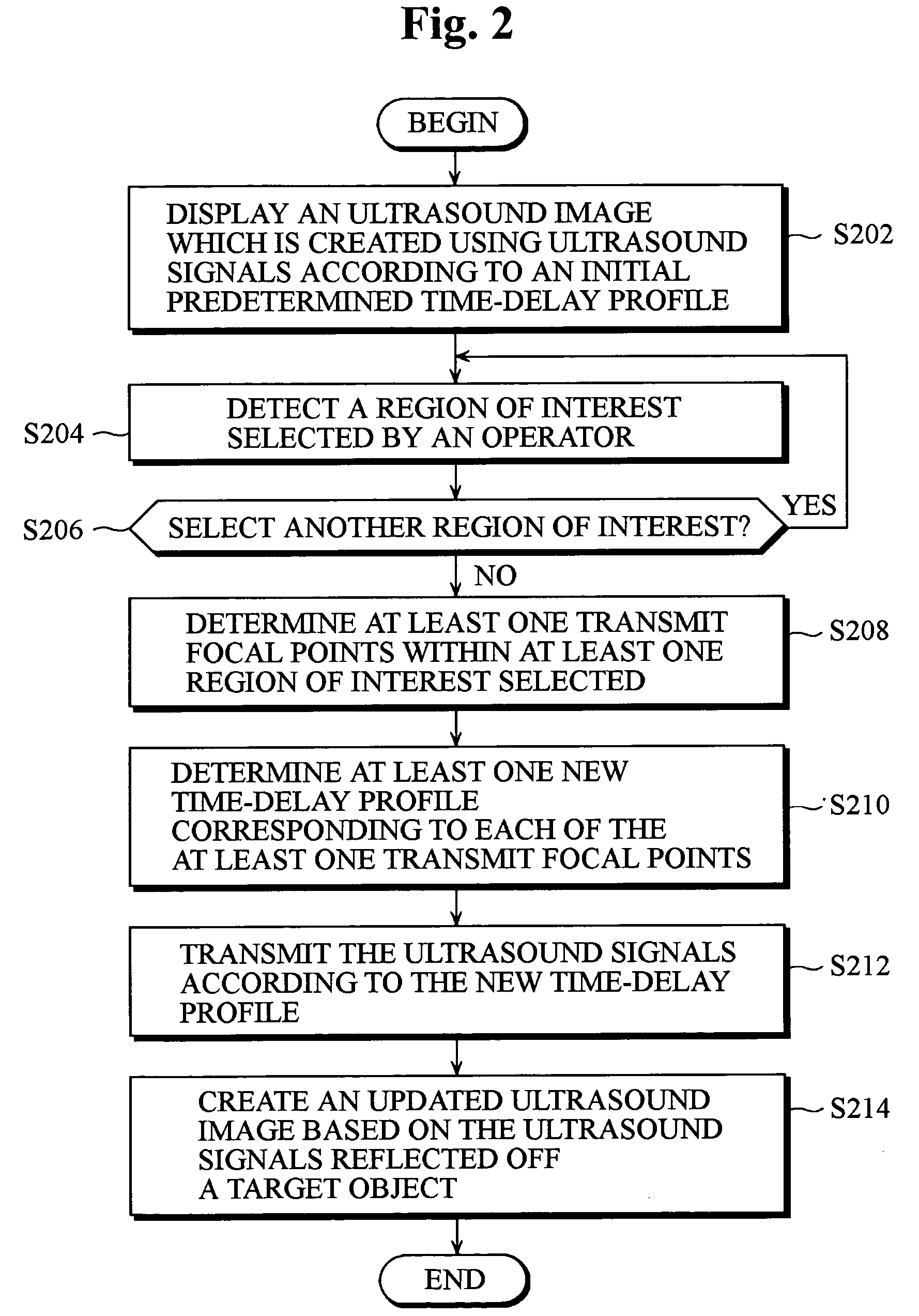 Ultrasound imaging apparatus having a function of selecting transmit focal points and method thereof