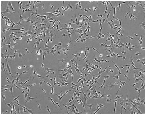 Human umbilical cord mesenchymal stem cell injection, preparation method and application thereof