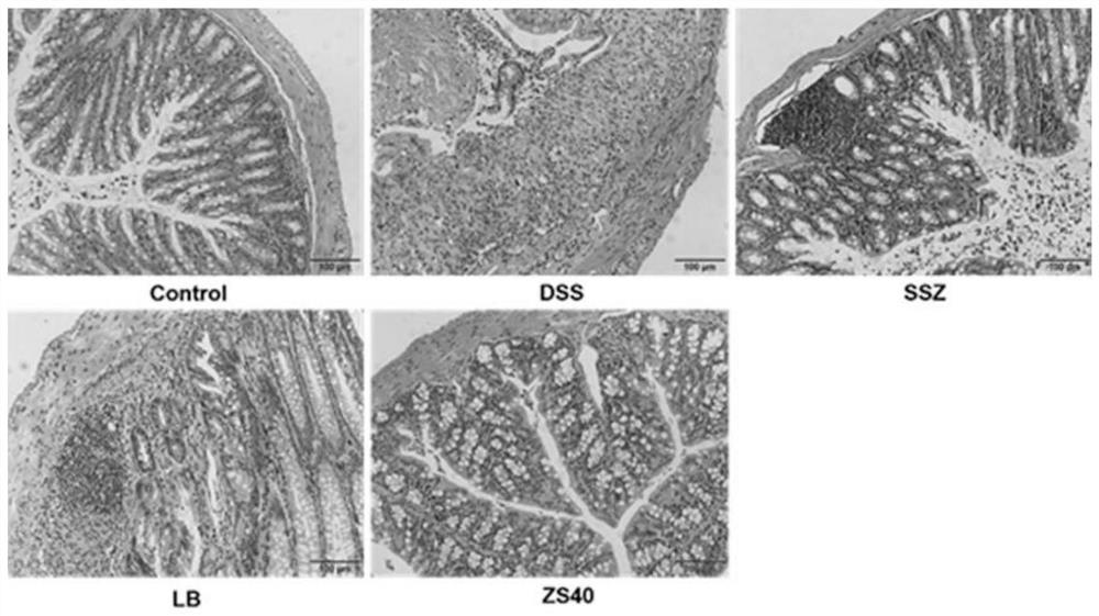 Lactobacillus fermentum ZS40 having prophylactic effect on colitis