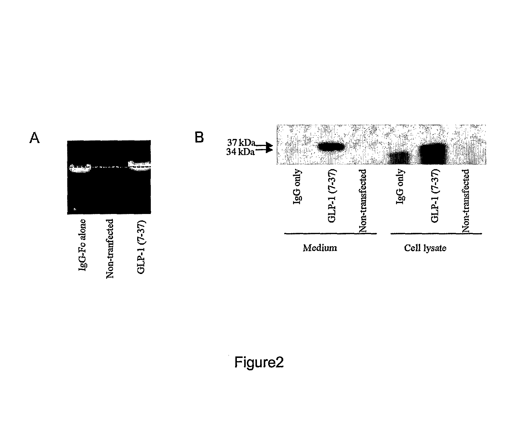 Composition and method for prevention and treatment of type I diabetes