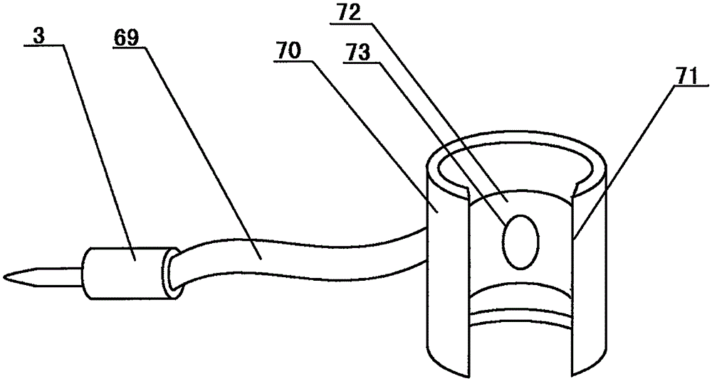 Upper gastrointestinal hemorrhage nursing device for department of gastroenterology