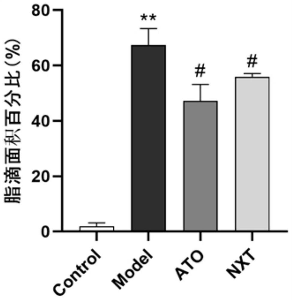 Application of Naoxintong preparation in preparation of medicine for treating non-alcoholic fatty liver disease