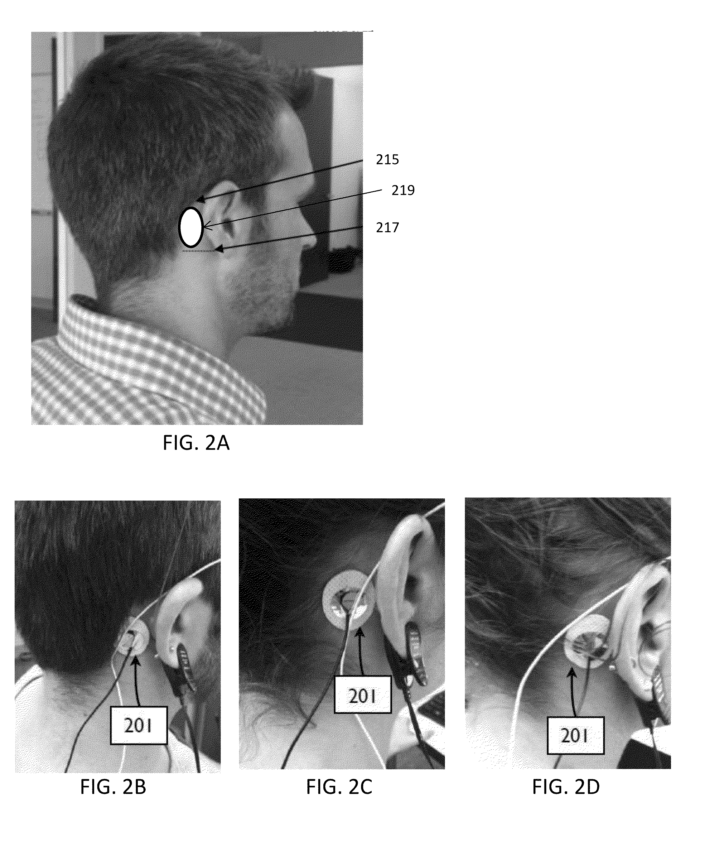 Transdermal electrical stimulation methods for modifying or inducing cognitive state