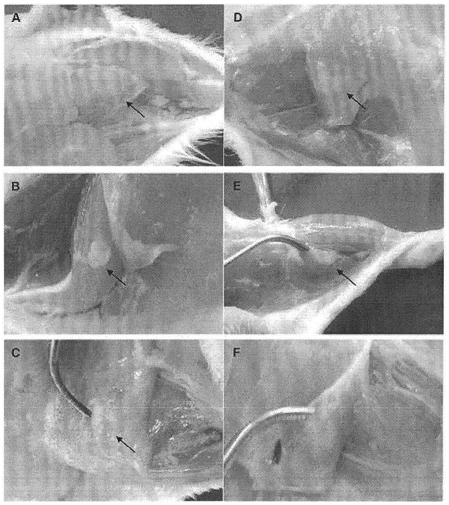 A kind of absorbable fracture internal fixation material and its preparation method and application