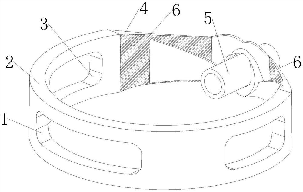 Nasogastric tube fixing band for nasal feeding patient