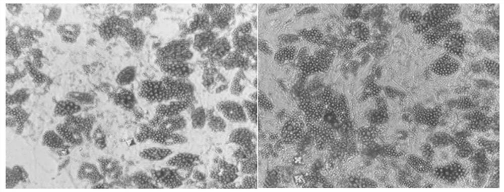 Anti-wrinkle essence containing adipose-derived stem cell extract and preparation method of anti-wrinkle essence