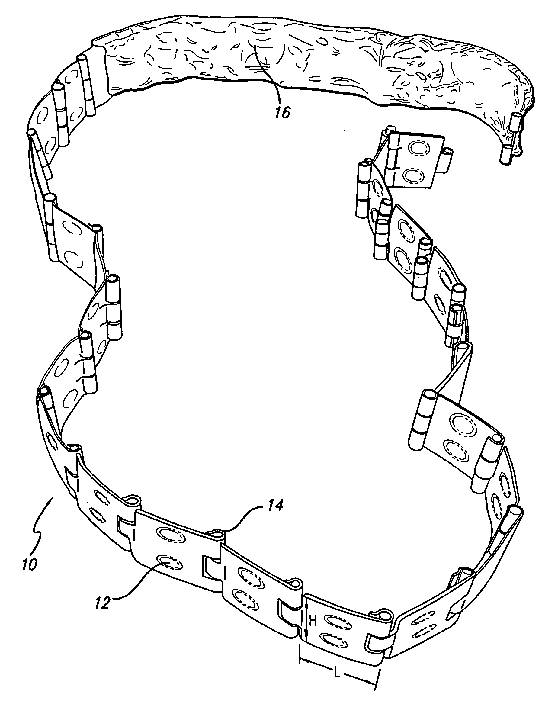 Flexible baking apparatus